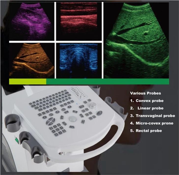 China Trolley Ultrasound Machine