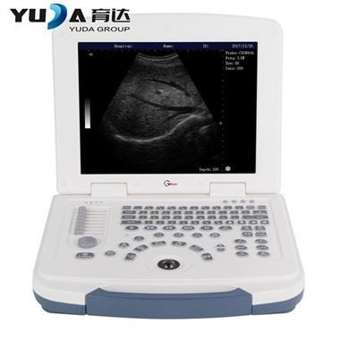 3D لیپ ٹاپ ڈیجیٹل الٹراساؤنڈ سکینر مشین